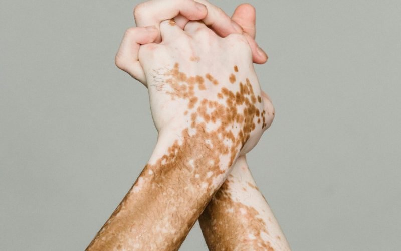 pexels-armin-rimoldi-5304809